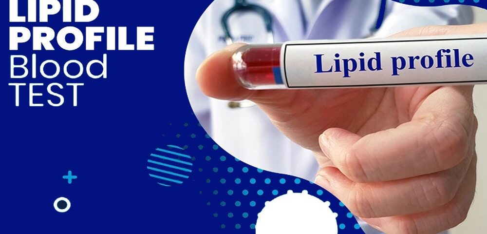 10 important advantages of a lipid profile test for cholesterol and heart health