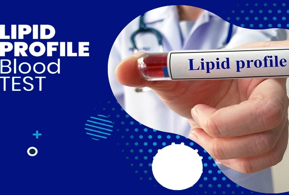 10 important advantages of a lipid profile test for cholesterol and heart health